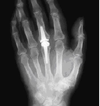 R&ouml;ntgenaufnahme (Foto: Klinik Bleicherode)