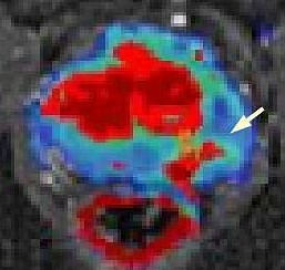 MRT von Prostata (Foto: SHK)