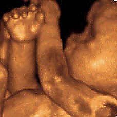 Die vierte Dimension (Foto: nnz)