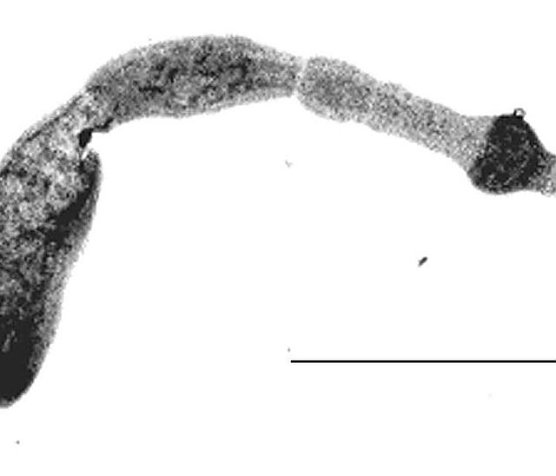 Fuchsbandwurm (Foto: Wikipedia)