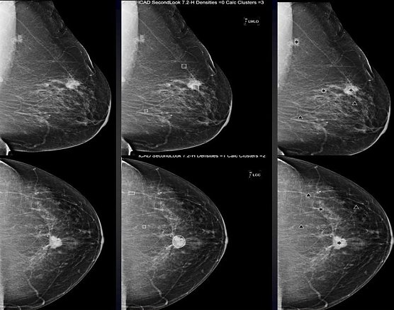 Darstellung (Foto: privat/SHK) Darstellung (Foto: privat/SHK)