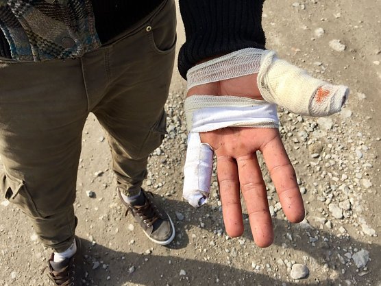 Vom Stacheldraht zeugen vernarbte Hände (Foto: Sara Müller) Vom Stacheldraht zeugen vernarbte Hände (Foto: Sara Müller)