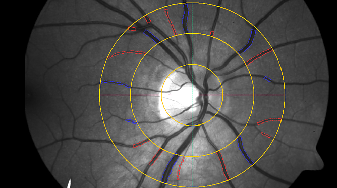 Weiterbildung im SBZ Vor Genröte (Foto: Landratsamt Nordhausen) Weiterbildung im SBZ Vor Genröte (Foto: Landratsamt Nordhausen)
