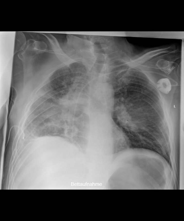 Liegendaufnahme mit SkyFlow Technologie