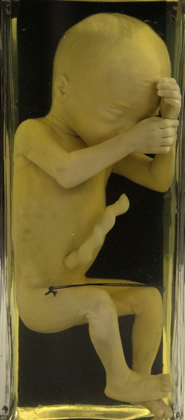 Echte K&ouml;rper zum Bestaunen