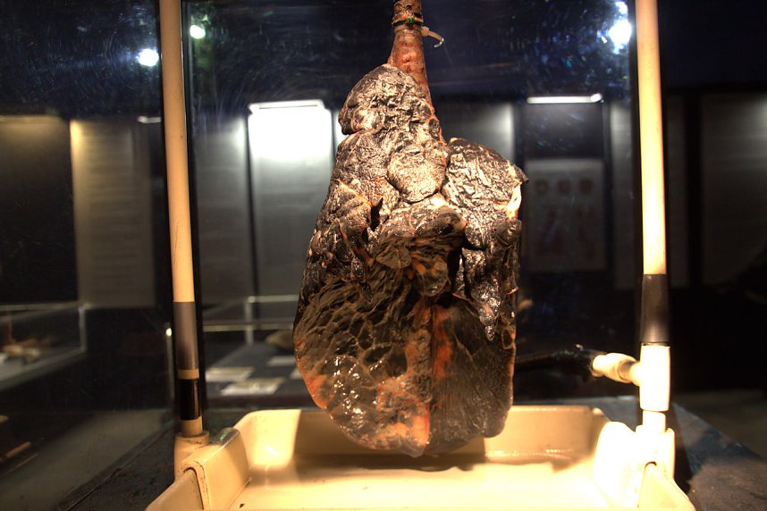 Echte K&ouml;rper zum Bestaunen