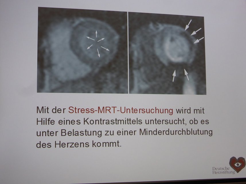 Herzsportgruppe blickt auf ein erfolgreiches Jahr zur&uuml;ck